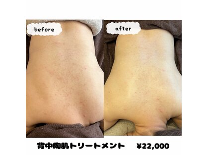 アンドリノ(&LINO)の写真