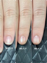 クーラ アンド ベリッシモ(Cura&Bellissimo)/縦長爪が理想！