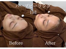 リネ(Rine)/くすみ改善にも◎