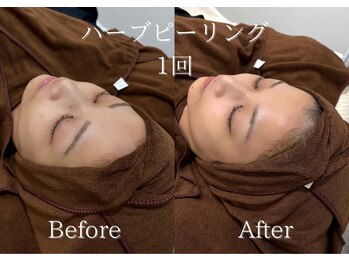 リネ(Rine)/くすみ改善にも◎