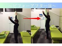 ケアるら整骨院 富里院/ビフォーアフター