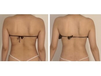 エトワール(etoile)/各種ディプロマ