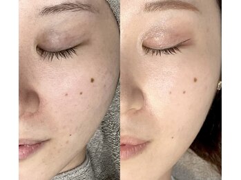 フィオーレ(Fiore)の写真/【シミ・しわ改善に本気で向き合う】年齢肌の根本にアプローチする本格エイジングケア