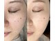 フィオーレ(Fiore)の写真/【シミ・しわ改善に本気で向き合う】年齢肌の根本にアプローチする本格エイジングケア