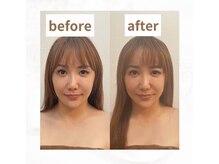 グレースフィオーレ モラージュ柏店(gracefiore)/【ヘッドスパ】ビフォーアフター