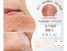 新規様　毛穴洗浄×顔脱毛×ビタミンCパック　¥12,320→ ¥9,850