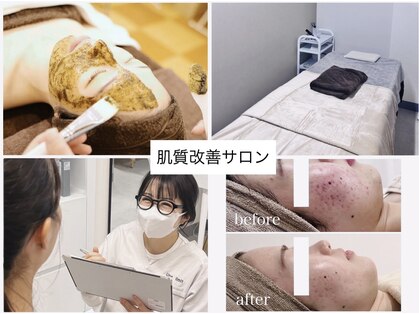 アンリミット 鹿児島天文館店(Une limit)の写真
