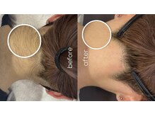 ミモザ(MIMOZA)の雰囲気（イベントの前撮りなどに向けて後ろ姿美人目指しませんか？(^^)☆）