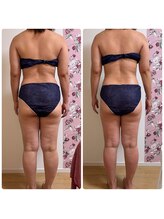 シュガー(Sugar...iyr)/全身痩身