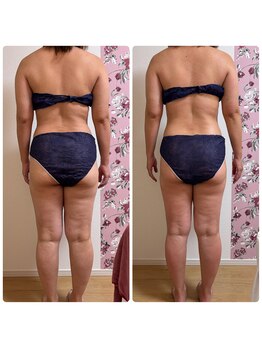 シュガー(Sugar...iyr)/全身痩身