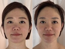 ジョーヌ(JAUNE)の雰囲気（立体小顔デザインでマイナス5歳印象へ！大人女性から支持◎）