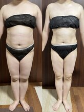 ヴィム(VIM)/ハイパーナイフビフォーアフター