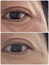 ひびき 京都烏丸御池店/目のまわりスッキリで若見え！