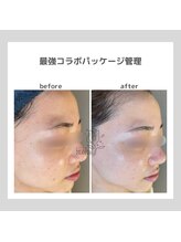 ポムハヌル(pom.haneul)/韓国肌管理室