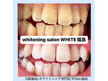 ホワイトニングサロン ホワイト(WHITE)/セルフホワイトニング/大阪/福島
