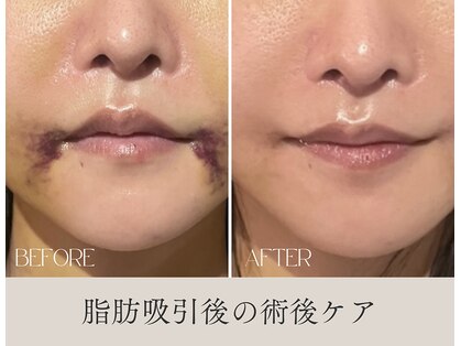 エッセンスビー 六本木(Essence Be)の写真