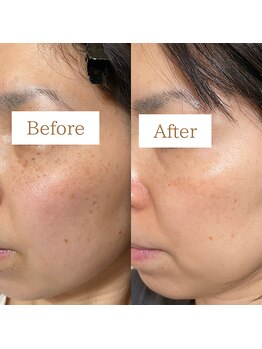 キレイノココロミ(きれいのCoCoRomi)/