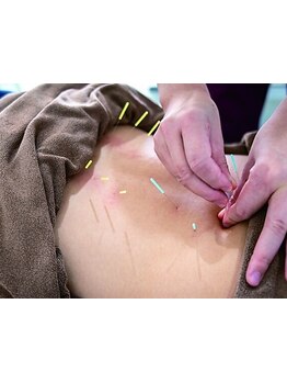 鍼灸施術を受けたい