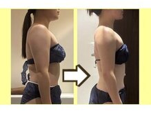 ビオール 新宿店(beall)の雰囲気（くびれ&薄いお腹に♪ぽっこりお腹とおさらば！痩身/二の腕/脚）