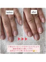 シャンス(chance)/冬の乾燥対策に！