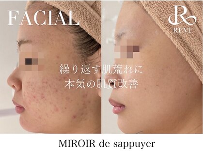 ミロワール ドゥ サピュイェ(MIROIR de Sappuyer)の写真
