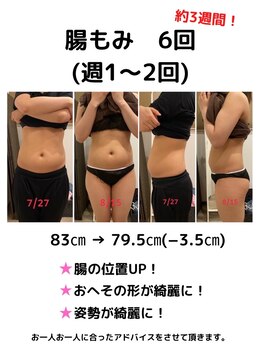 ベイス(BASE)/【20代/看護師/産後で痩せたい】