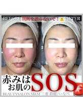 エムアンドエム(M&M)/