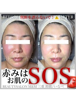 エムアンドエム(M&M)/