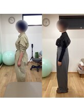 ランドル(rendre)/４０代女性　スウェイバック姿勢