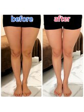 クオコア(KUOKOA)/足のラインを綺麗にします！