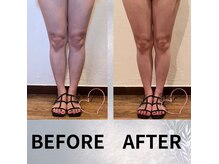 トレ ジョリ(Tre’s Jolie)の雰囲気（【 WINBACK  】ラジオ波/痩身/引き締め/ストレッチマーク改善）