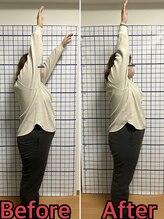 幸鍼灸整体院 武庫之荘院/整体・トレーニング・姿勢変化4