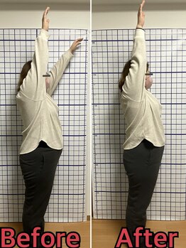 幸鍼灸整体院 武庫之荘院/整体・トレーニング・姿勢変化4