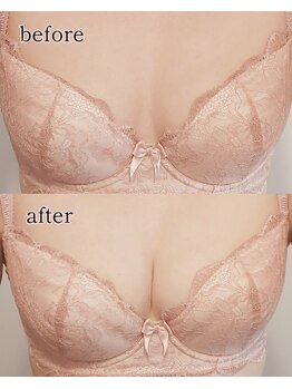 ブルーム(bluem)/バスト周りの筋膜リリース