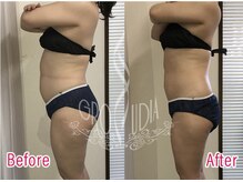 グラウディア 恵比寿/痩身/筋膜リリース/インディバ超