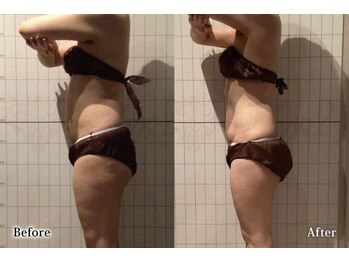 アネル 宮古島店(anel)/