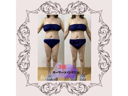 チャルメの写真