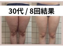 リストアミー(Restore me)/下半身太りもお任せください♪