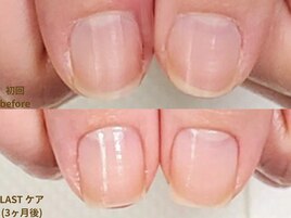 【地爪育成 症例 3】