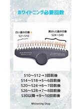 ホワイトニングショップ 宇城店/歯のトーン！