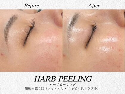 アデージョ アデオス(Ade-jyo.Adeosu)の写真