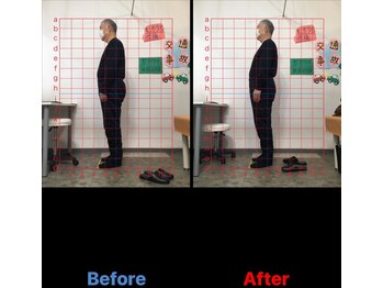 京成臼井駅前ひまわり整骨院/☆姿勢変化の写真☆