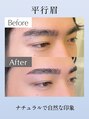 アイビーライン 川崎(IVY-LINE) 平行眉【Before→After】