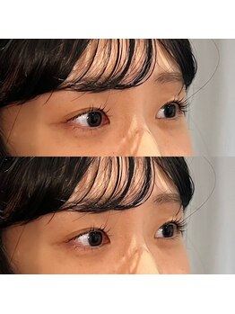 エミイ(eMii.)/横から見た時のナチュラル感◎