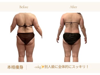 アランルージュ(ALANROUGE)/劇的★ビフォーアフター