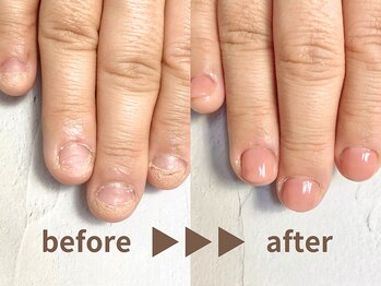 深爪から長さ出し+ワンカラー