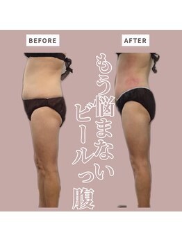 ソワン(Soin)/60代　お腹