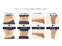 アロマジュ(AROMAZYU)/