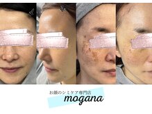 モガナ(mogana)