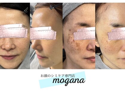 モガナ(mogana)の写真